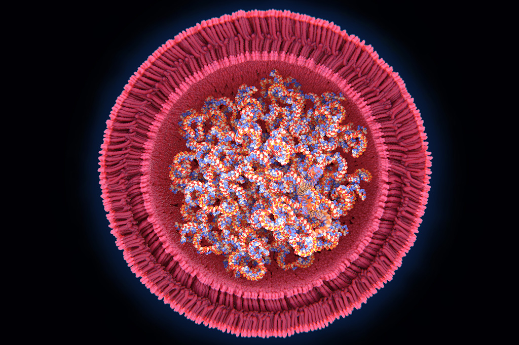 Lipid Nanoparticles: Nanomedicine’s Triumph